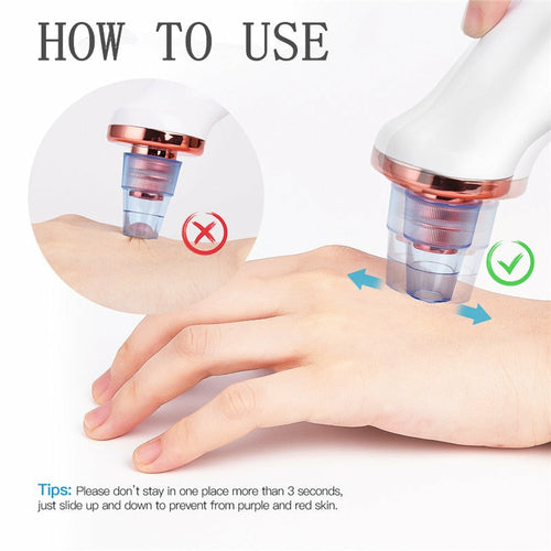 Blackhead Remover Vacuum Pro